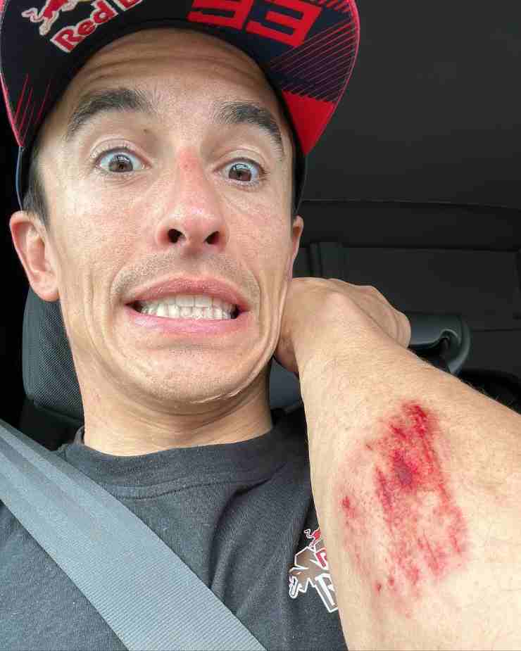 Marquez ferita caduta moto cross